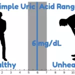 Normal Range of Uric Acid in Blood